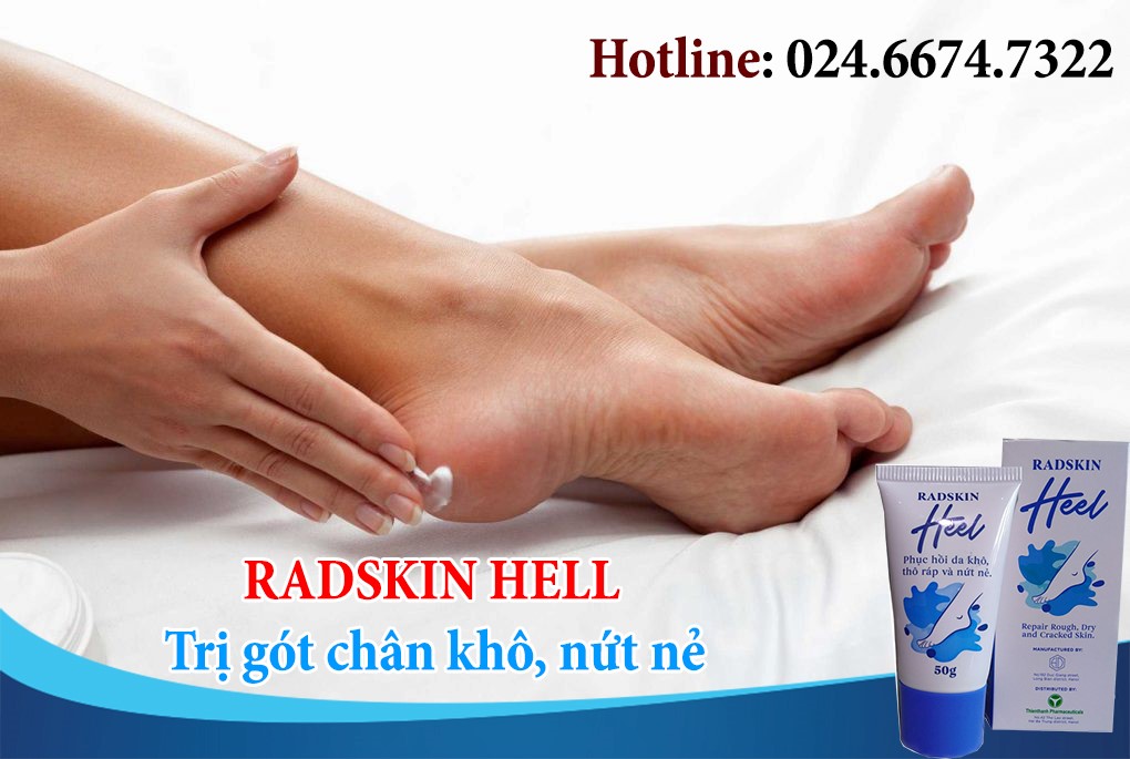Cách Trị gót chân khô, nứt nẻ Hiêu quả